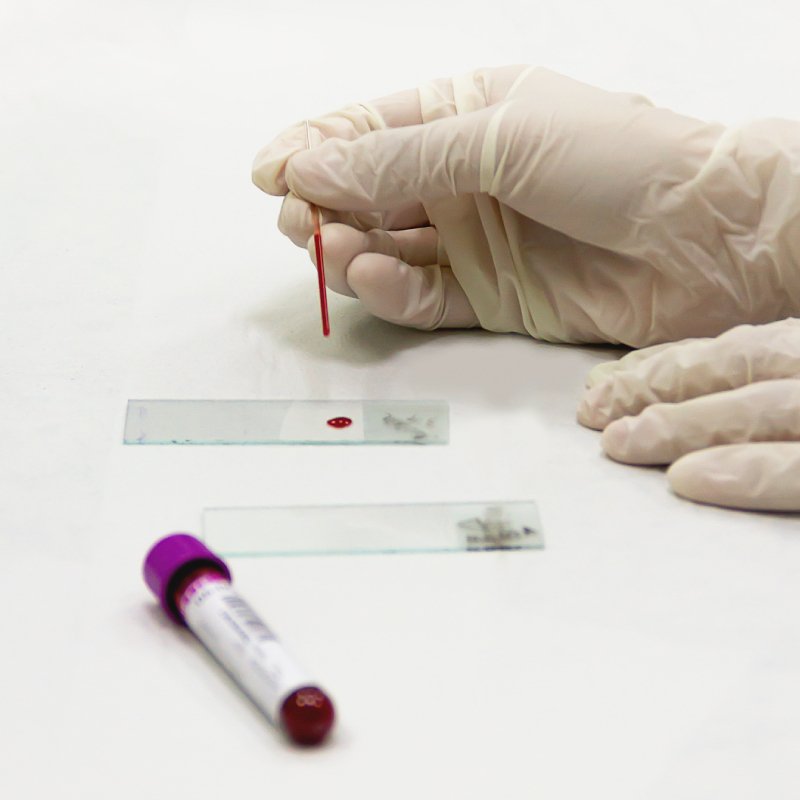At Home Blood Tests - Chemist Corner
